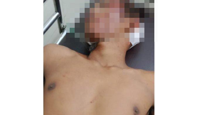 Begal Tewas Dikeroyok Massa Usai Tembak Balita