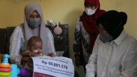 Mensos Bantu Balita Penderita Penyumbatan Saluran Empedu