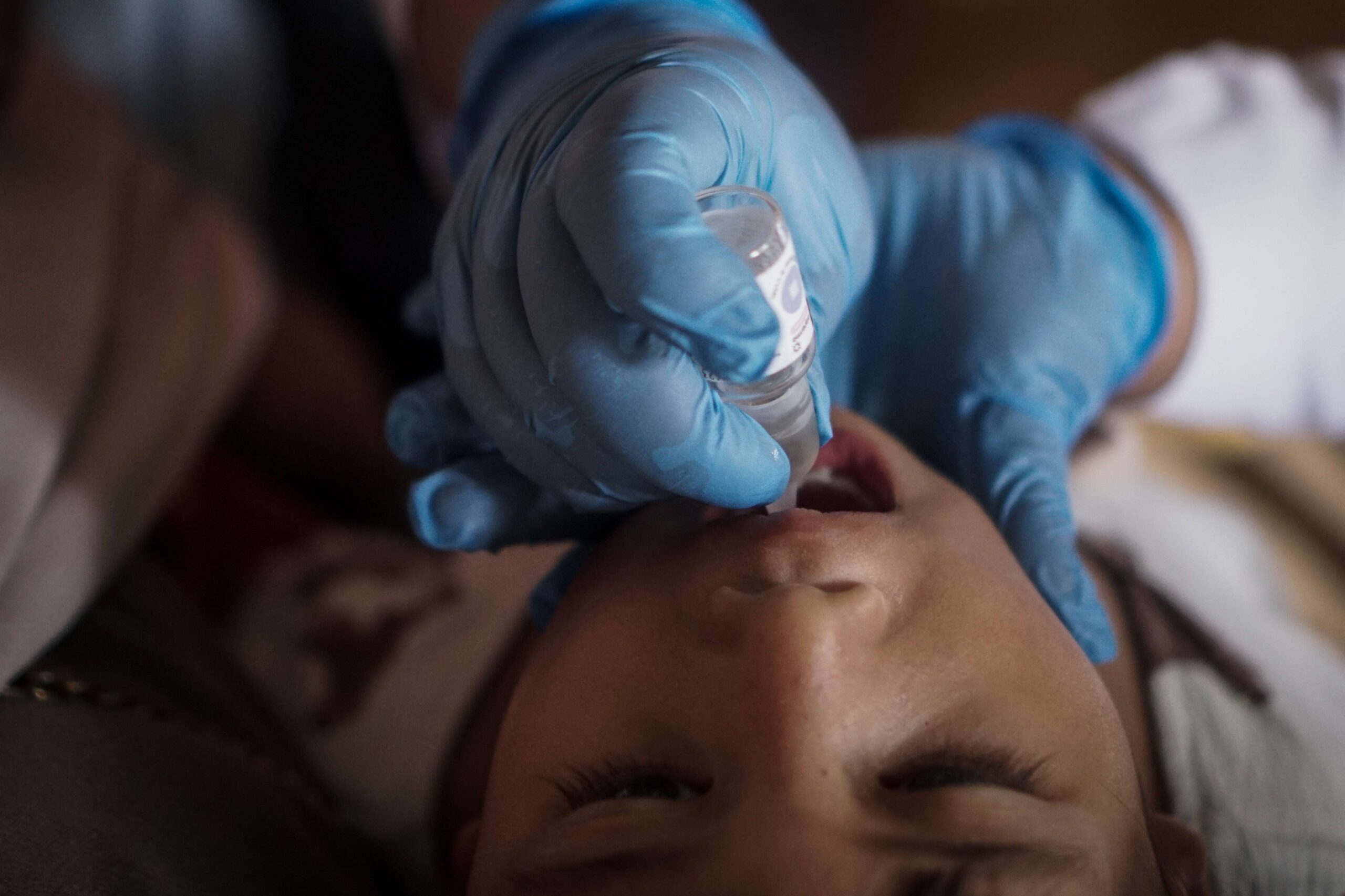 Jawa Timur Belum Penuhi Target Imunisasi Polio