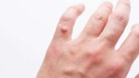 Pemerintah Perluas Sasaran Vaksin HPV pada Laki-laki