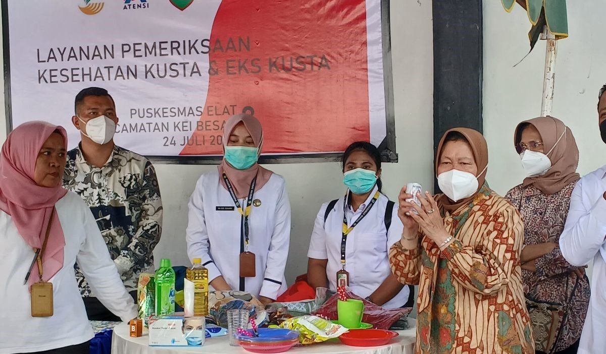 Mensos hapus stigma penderita kusta di Kei Besar, ajak berwirausaha