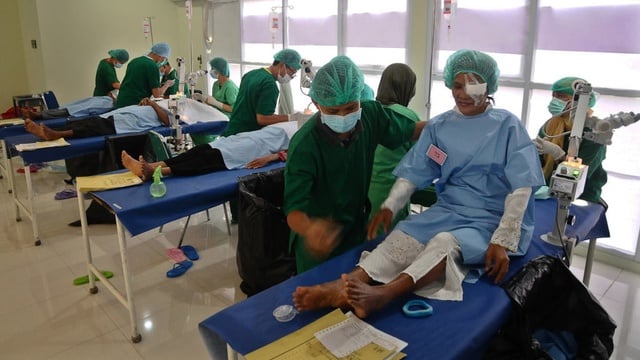 Ratusan orang jalani operasi katarak gratis Kanwil DJP Jakbar