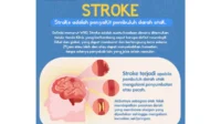 Stroke ringan bisa hilang 24 jam tapi tak bisa disepelekan