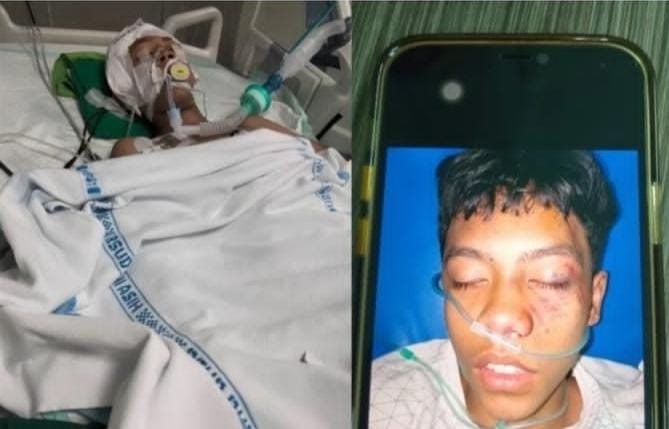 Pelajar SMA Islam As syafiiyah 01 Tebet Diduga Dianiaya Oleh kakak Kelasnya