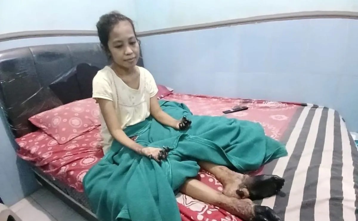 Migrant Care Jember berharap pemerintah bantu PMI Septa dapat haknya