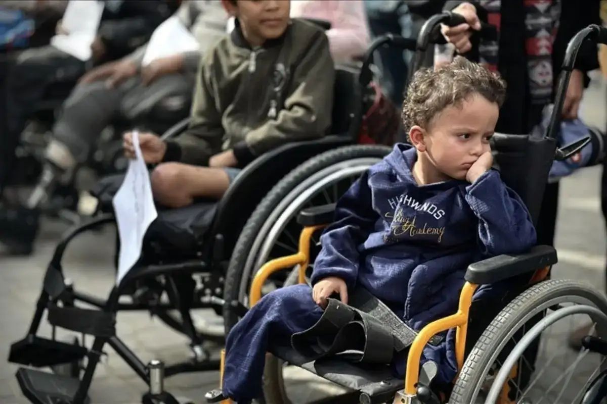 Ribuan Kasus Anak-anak Harus Diamputasi di Gaza
