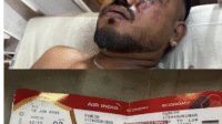 Inilah satu satunya penumpang Pesawat Air India yang Selamat dari Tragedi tersebut