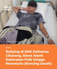 Siswa SMK di Cikarang Di-bully Kakak Kelas hingga Patah Tulang Rahang