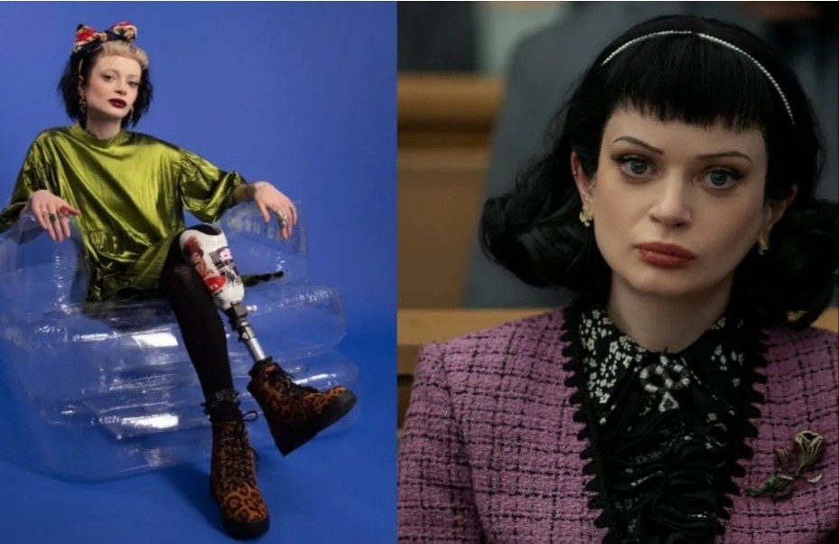 Ruth Codd jalani amputasi kedua