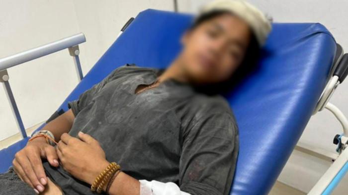 Polisi Masih Kejar Empat Pelaku Begal terhadap Remaja Baduy di Cempaka Putih