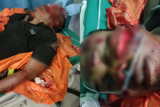 Street Food Vendor in Paluta Allegedly Victim of Violent Robbery